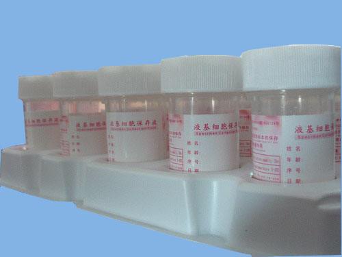 【HPV保存液的產(chǎn)品特點(diǎn)】它有什么特點(diǎn)？