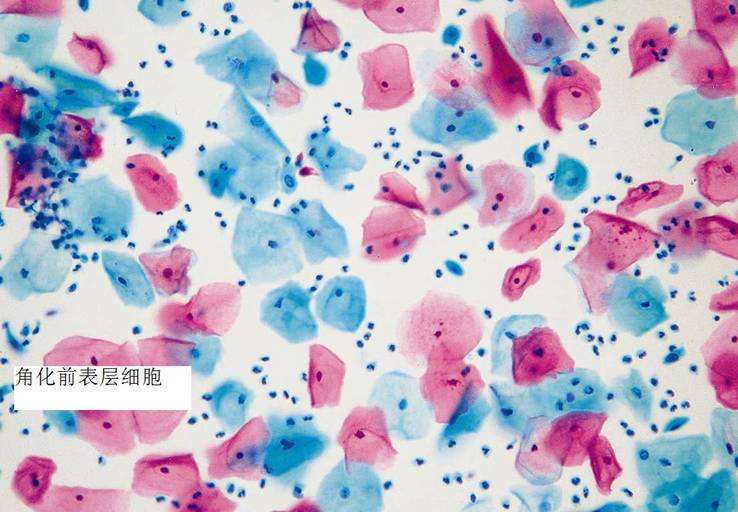 「巴氏染色液」巴士染色液具體作用和使用方法